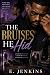 The Bruises He Hid