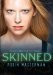 Skinned by Robin Wasserman