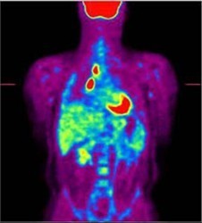 medicalisotopes