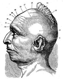 BlackHawkPhrenology