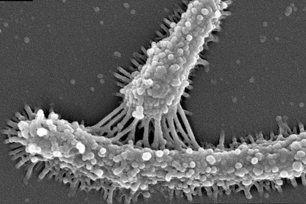 stewart bacteria
