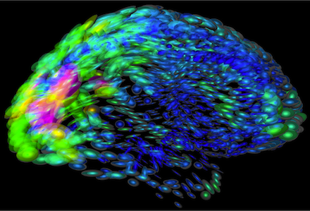 jellybean brain