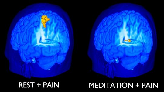 Signs of pain disappeared from MRI images of the brain when freshly trained novices meditated.