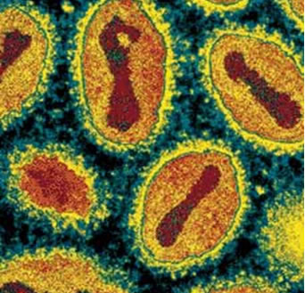 Smallpox-virus