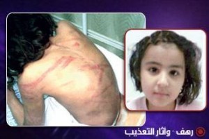 الطفلة المعذة رهف