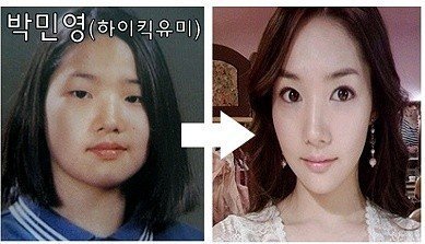 Park Min Young, one of Korea's top actresses, before and after plastic surgery.