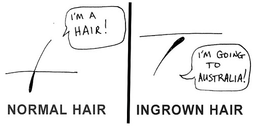 HAIRS