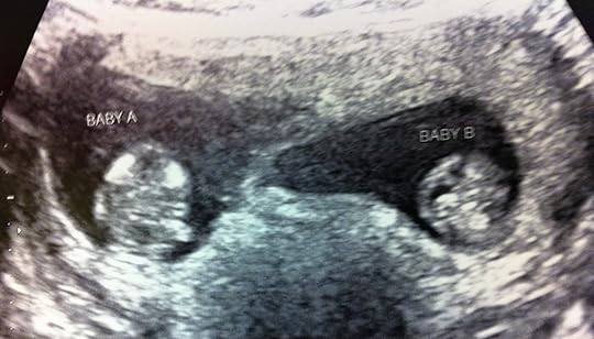 The obligatory blurry ultrasound photo! 
