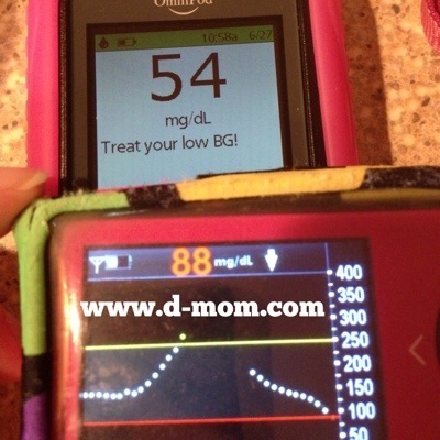 OmniPod DexCom