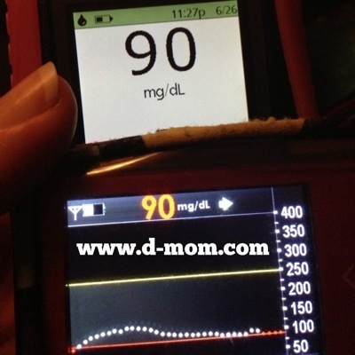 OmniPod DexCom