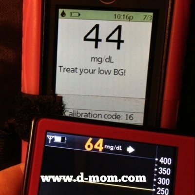 OmniPod DexCom Low Blood Sugar