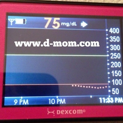 DexCom Blood Sugar