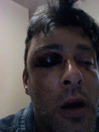 Dan Contarino, one of the latest victims of anti-gay violence in New York City (Facebook photo).