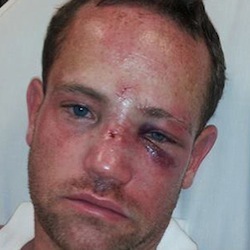 Jason Jacobs, gay 37-year-old, attacked in his own neighborhood.