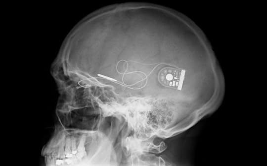 xray_bionic_sight