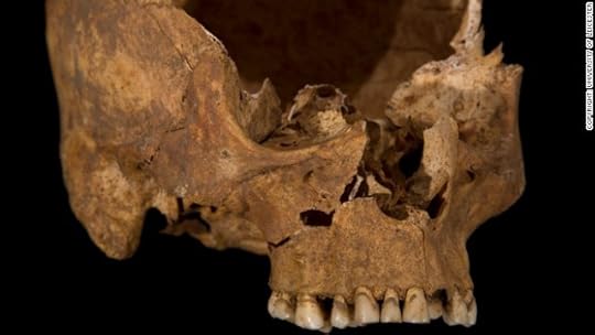 A wound to the cheek, possibly caused by a square-bladed dagger. The front part of the skull has separated naturally along the line of a suture (a joint between the skull bones), which is why it is not present in this picture. This would have fused as Richard became older had he lived.