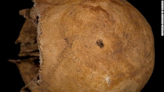 The penetrating injury to the top of the head. "The skull was in good condition, although fragile, and was able to give us detailed information," said Jo Appleby, a lecturer in human bioarchaeology at the university who led the exhumation of the remains last year.