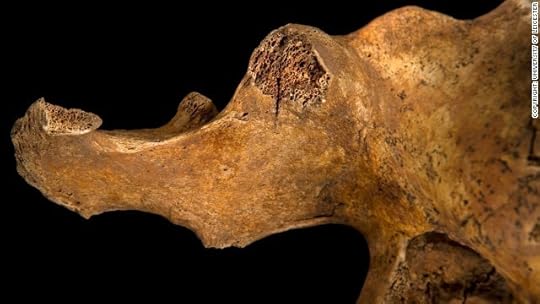 The image shows a blade wound to the pelvis, which has penetrated all the way through the bone.