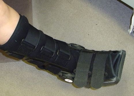 foot injury