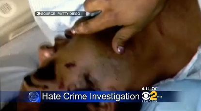 Diego shows multiple injuries sustained in Thursday night's attack.