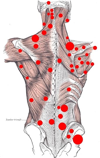 whole-back-trigger-points