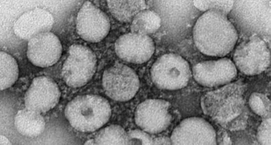Transparency Unlocked: More New Saudi Coronavirus Cases Reported Quickly