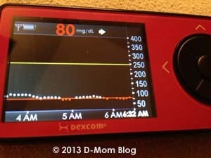 CGM Low Threshhold