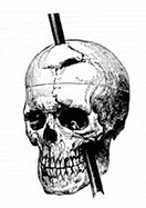 Image from Wikipedia. Click for source.
