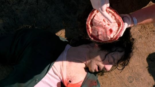 The Brain Surgeon