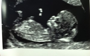 babynews