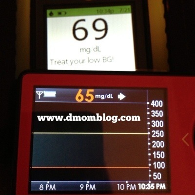 OmniPod DexCom Low Blood Sugar