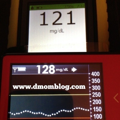 OmniPod DexCom Blood Sugar