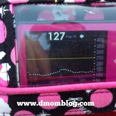 DexCom Blood Sugar