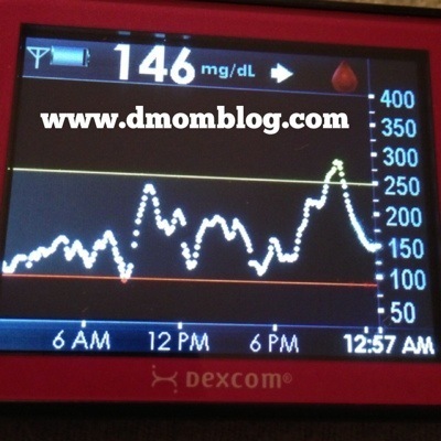 DexCom Blood Sugar
