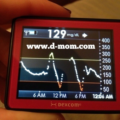 DexCom BG Swing