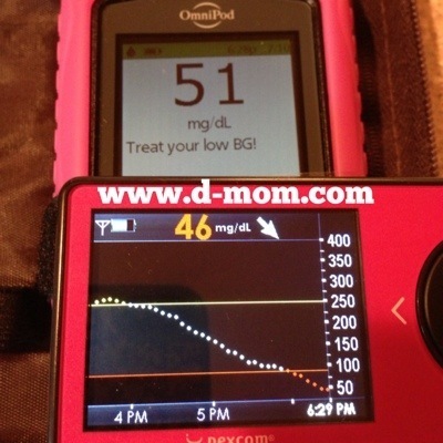 OmniPod DexCom Low BG