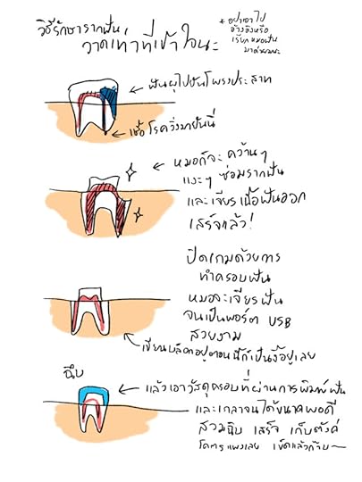 รักษารากฟัน