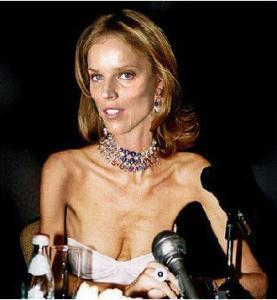 anorexia, eating disorders, models, fashion industry, plus sizes, modeling, fashion, health, starvation