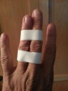 Dislocated left ring finger, mine.