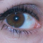 one eye