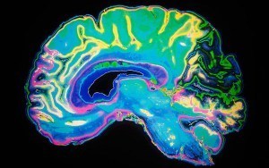 dream brain