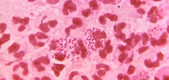 Almost-Untreatable Gonorrhea: Proof That It’s Here