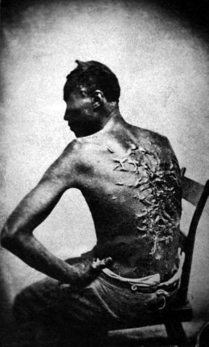 Scars of a whipped slave (April 2, 1863, Baton...