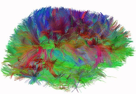 Human Brain Wiring