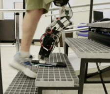 mindcontrolledprosthetic