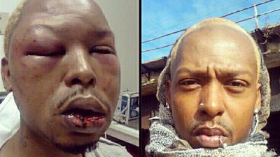 Christmas gay bashing victim Kenni Shaw, 30, before and after attack. (Instagram image posted by the victim.)