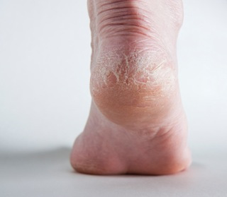barefoot