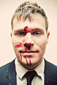 Ryan Langenegger, straight friend who took a beating standing up for gay friends in Omaha.