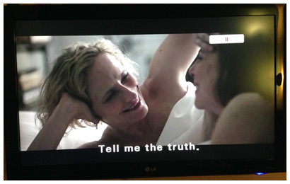 Concussion