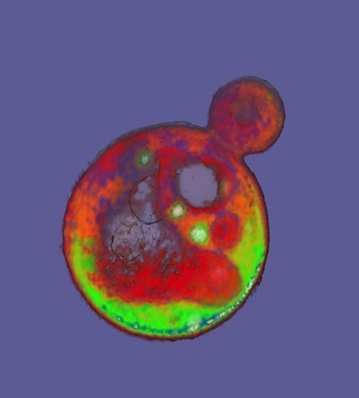 A lone yeast cell budding off a daughter cell. Photo by Carolyn Larabell. http://publications.nigms.nih.gov/biobeat/05-06-21/
